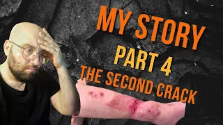 How I lost my leg Part 4 - The second crack