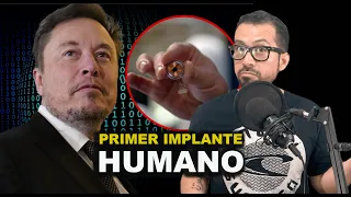 Realizado el Primer Implante de Neuralink en Humanos