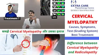 Cervical Myelopathy Physiotherapy Treatment | Causes, Symptoms, Test & Grading | NO SURGERY NEEDED