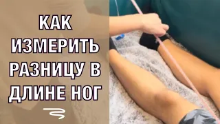 Измеряем Разницу в Длине Ног. Протез. Hip Replacement. How to measure legs difference (Eng subt)