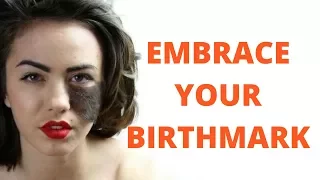 Why BIRTHMARKS do NOT need to be removed