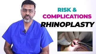 The Risks of Rhinoplasty: Everything You Need To Know