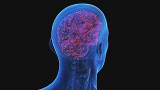 Recognizing and Reacting to Stroke Signs: What You Need to Know