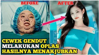 Cewek Gendut Ini Melakukan OPLAS Karena Sering Diejek - Alur Cerita Film 200 Pounds Beauty