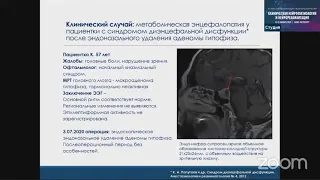 Значение ЭЭГ у пациента с опухолями головного мозга. Баранова Е.А. Казань