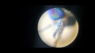 a mosquito under tha microscope 100 to 150× magnification.. just the head