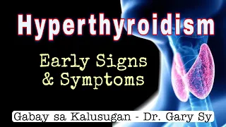 Hyperthyroidism: Early Signs & Symptoms - Dr. Gary Sy