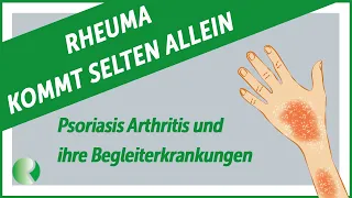 📢Rheuma kommt selten allein: Psoriasis Arthritis und ihre Begleiterkrankungen