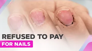 Nail Tech Damaged the Nails | Nail Extensions | Heart Nail Art