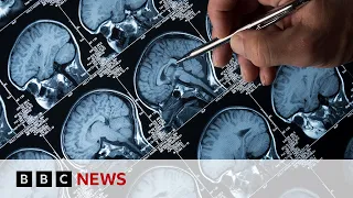 Using virtual reality to diagnose Alzheimer's disease | BBC News