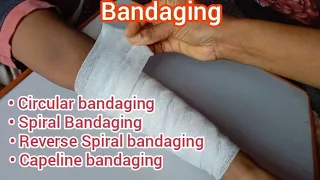 Bandaging and its Types || Capeline bandaging, Circular bandaging, Spiral bandaging, Reverse Spiral