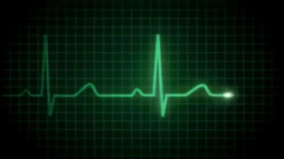 EKG