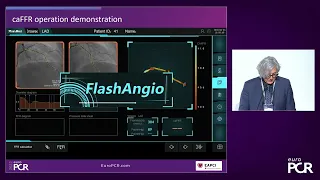 Angiography-derived physiological assessment of coronary artery stenosis severity - EuroPCR 2022