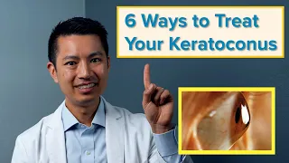The 6 Best Ways to Treat Your Keratoconus
