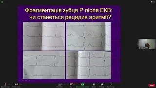 Фібриляція і тріпотіння передсердь. Тактика ведення пацієнтів. (Жарінов О.Й.). Лекція 02.11.22р.