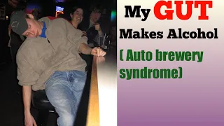 What is auto brewery syndrome | Gut fermentation | Drunk without drinking alcohol