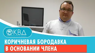 😟 Коричневая бородавка в основании члена. Клинический случай №544