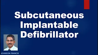 Subcutaneous Implantable Defibrillator