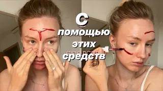 как я вылечила кожу - лучшие средства