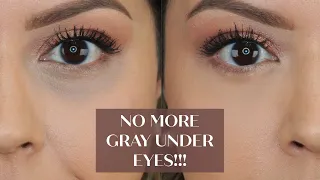 NO MORE GRAY UNDER EYES!!! HOW TO: CONCEAL DARK CIRCLES WITHOUT IT TURNING GRAY