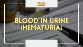 Blood in Urine (Hematuria) Part 3 | Usapang Pangkalusugan