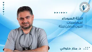 اللثة الداكنة | تعرف على اهم اسباب اللثة السوداء