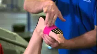 Kinesio Clinical Video Introduction - Sport & Fitness