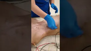 Scrubbing a surgical site