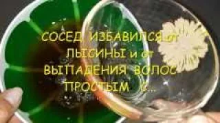 Сильнейшая Маска При Сильном Выпадении Волос!