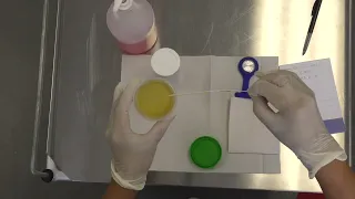 Urinalysis