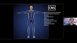 Neurological Manifestations of Amyloidosis