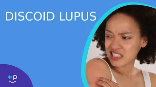 Discoid Lupus - Daily Do's of Dermatology