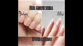 Nail growth serum... Growing nails in just 10 days