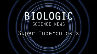 Science News - Super Tuberculosis