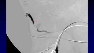 Imaging of the Eye and Orbit, Part 6