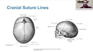 ICU Brain Trauma Management Part 1 (Step 2)