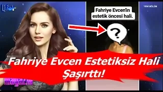 Fahriye Evcen Estetiksiz Hali Şaşırttı! - Magazin Haberleri