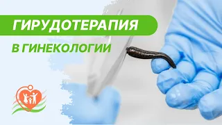 👩‍⚕️  Гирудотерапия в гинекологии. Пиявки