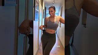 Vanessa Simmons Two Month Liposuction Update | Sono Bello Lipo360