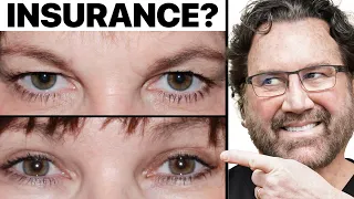 Is Eyelid Surgery Covered By Insurance? Surgeon Answers