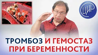 Гемостаз и тромбоз при беременности. ВЯЗКОСТЬ и СВЁРТЫВАЕМОСТЬ крови. Рассказывает Гузов И.И.