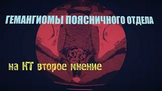 ГЕМАНГИОМА позвоночника и ПРОТРУЗИЯ поясничного отдела L4-Ll5 на РАСШИФРОВКЕ КТ (второе мнение)