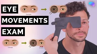 Eye Movements & Cover Test | CN III, IV, VI | OSCE Clip | UKMLA | CPSA