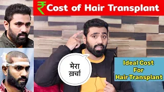 My Hair Transplant Cost💲| ideal Cost for Hair Transplant | समझदारी से Hair Transplant कराये