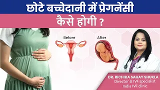 गर्भाशय छोटा है तो प्रेगनेंसी ठहरेगी या नहीं? Hypoplastic Uterus | Dr. Richika Sahay Shukla