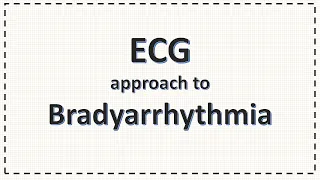 ECG Approach to Bradyarrhythmia | Bradycardia | Simplified