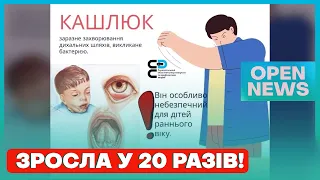 В Україні стрімко зростає захворюваність на кашлюк