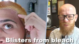 He has blisters from bleach !  - Hair Buddha reaction video #hair #beauty
