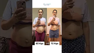 83 kgs to 72 kgs BELLY FATLOSS // MyHealthBuddy