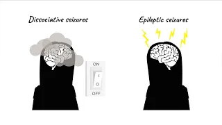 The CODES trial for dissociative seizures